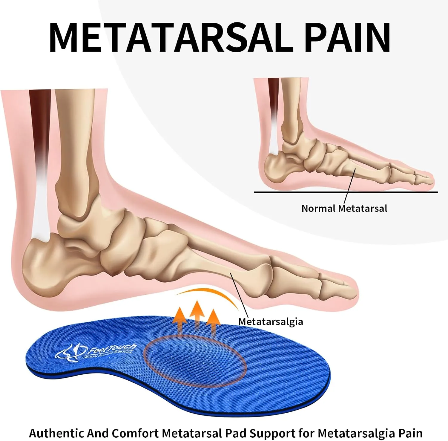 Arch Support Orthotics Metatarsal Pads Orthopedic Inserts for Morton's Neuroma,Ball of Foot Pain Relief Memory Foam Insoles with Poron Heel Cushion (Blue, Men9-9.5/Women11-11.5)
